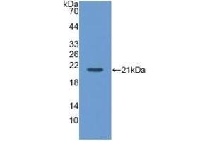 Detection of Recombinant MGA, Human using Polyclonal Antibody to Maltase-glucoamylase (MGAM) (Maltase-Glucoamylase (MGAM) (AA 213-392) antibody)