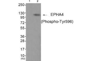 Western blot analysis of extracts from JK cells (Lane 2), using EPHA4 (Phospho-Tyr596) Antibody. (EPH Receptor A4 antibody  (pTyr596))