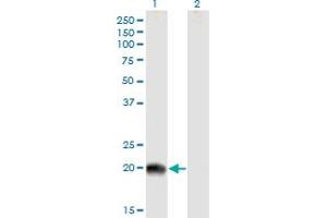 Western Blot analysis of RS1 expression in transfected 293T cell line by RS1 MaxPab polyclonal antibody. (RS1 antibody  (AA 1-224))