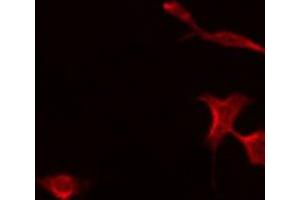 ABIN6275476 staining A549 by IF/ICC. (PTPRZ1 antibody  (N-Term))