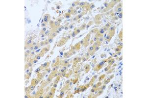 Immunohistochemistry of paraffin-embedded human liver using STC1 antibody (ABIN5975425) at dilution of 1/100 (40x lens). (Stanniocalcin 1 antibody)