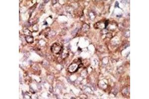 Immunohistochemistry (IHC) image for anti-BCL2-Associated Agonist of Cell Death (BAD) (AA 92-127) antibody (ABIN3030135)