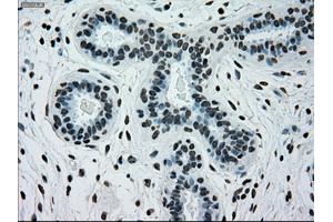 Immunohistochemical staining of paraffin-embedded breast tissue using anti-SILV mouse monoclonal antibody. (Melanoma gp100 antibody)