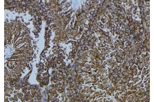 ABIN6276665 at 1/100 staining Mouse testis tissue by IHC-P. (CYP1B1 antibody  (Internal Region))