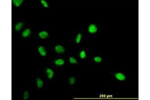 Image no. 2 for anti-Nucleophosmin (Nucleolar phosphoprotein B23, Numatrin) (NPM1) (AA 1-295) antibody (ABIN598843) (NPM1 antibody  (AA 1-295))