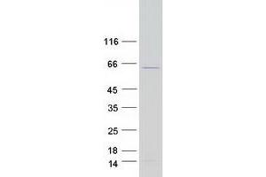 Western Blotting (WB) image for Pre-mRNA Processing Factor 31 (PRPF31) protein (Myc-DYKDDDDK Tag) (ABIN2729830)