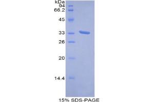 SDS-PAGE analysis of Human Metallothionein 1E Protein.