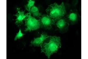 Anti-MAPRE2 mouse monoclonal antibody (ABIN2454544) immunofluorescent staining of COS7 cells transiently transfected by pCMV6-ENTRY MAPRE2 (RC200259). (MAPRE2 antibody)