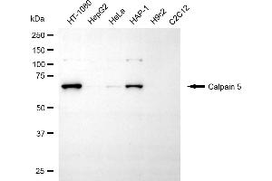 Western blotting analysis using calpain 5 antibody (ABIN7797848).