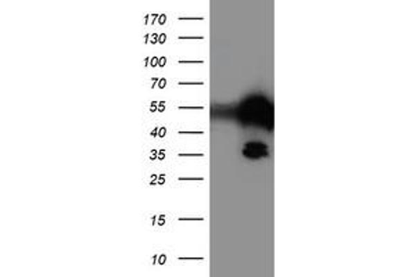 TAL1 antibody