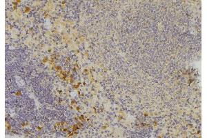 ABIN6272568 at 1/100 staining Human lymph node tissue by IHC-P. (CCBE1 antibody  (Internal Region))