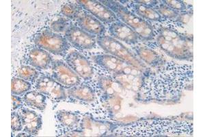 IHC-P analysis of Rat Intestine Tissue, with DAB staining. (Cytokeratin 18 antibody  (AA 72-380))