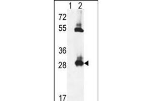 Western blot analysis of TPK1 (arrow) using rabbit polyclonal TPK1 Antibody (N-term) (ABIN653087 and ABIN2842683). (TPK1 antibody  (N-Term))