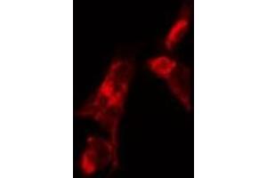 ABIN6268790 staining HUVEC by IF/ICC. (FSHR antibody  (Internal Region))