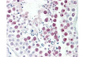 Human, Testis: Formalin-Fixed Paraffin-Embedded (FFPE). (MDC1 antibody  (AA 1851-1900))
