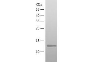 Western Blotting (WB) image for SET Domain Containing (Lysine Methyltransferase) 8 (SETD8) (AA 195-352) protein (His tag) (ABIN7288987) (SETD8 Protein (AA 195-352) (His tag))