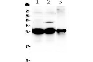 Western blot analysis of MBL2 using anti-MBL2 antibody . (MBL2 antibody  (AA 19-244))