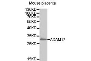 Western Blotting (WB) image for anti-ADAM Metallopeptidase Domain 17 (ADAM17) antibody (ABIN2650893) (ADAM17 antibody)