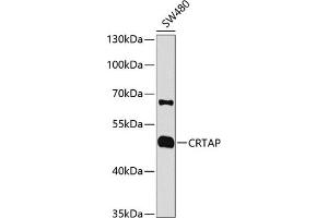 Western blot analysis of extracts of SW480 cells, using CRTAP antibody (ABIN1679366, ABIN3018913, ABIN3018914 and ABIN6220627) at 1:1000 dilution. (CRTAP antibody  (AA 20-240))