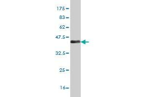 Western Blot detection against Immunogen (37 KDa) . (MEF2A antibody  (AA 71-170))