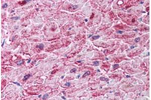 Human Heart (formalin-fixed, paraffin-embedded) stained with IKBKB antibody ABIN297183 at 2. (IKBKB antibody  (AA 310-376))