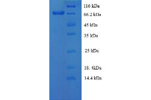SDS-PAGE (SDS) image for Albumin (ALB) (AA 25-608) protein (His tag) (ABIN5713212)