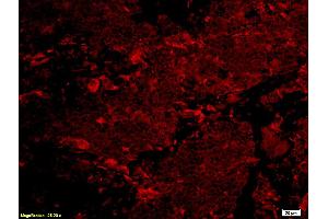 Immunofluorescence (IF) image for anti-Nuclear Factor of kappa Light Polypeptide Gene Enhancer in B-Cells Inhibitor, alpha (NFKBIA) (pSer32), (pSer36) antibody (ABIN741360)