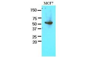 Cell lysates of MCF7 (30 ug) were resolved by SDS-PAGE, transferred to nitrocellulose membrane and probed with anti-human G6PD (1:1000). (Glucose-6-Phosphate Dehydrogenase antibody  (AA 35-506))