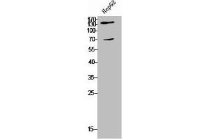 Western Blot analysis of HepG2 cells using COL5A2 Polyclonal Antibody (COL5A2 antibody  (N-Term))