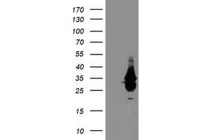 HEK293T cells were transfected with the pCMV6-ENTRY control (Left lane) or pCMV6-ENTRY OBFC2B (Right lane) cDNA for 48 hrs and lysed. (SSBP1 antibody)