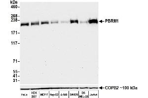 Western Blotting (WB) image for anti-Polybromo 1 (PBRM1) (AA 1-293) antibody (ABIN7454032)