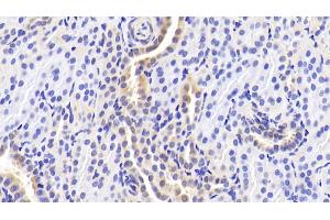 Immunohistochemistry (IHC) image for anti-Tumor Necrosis Factor Receptor Superfamily, Member 11a, NFKB Activator (TNFRSF11A) (AA 330-615) antibody (ABIN7434629)