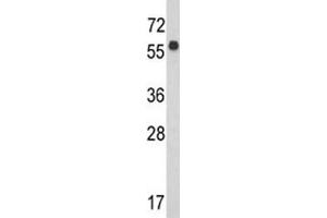 Western blot analysis of WDR1 antibody and CEM lysate. (WDR1 antibody  (AA 548-577))