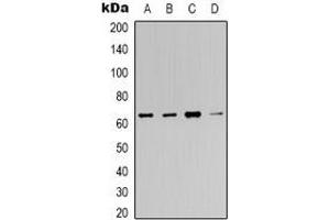 Western blot analysis of c-FOS expression in Hela (A), 293T (B), mouse brain (C), rat brain (D) whole cell lysates. (c-FOS antibody)