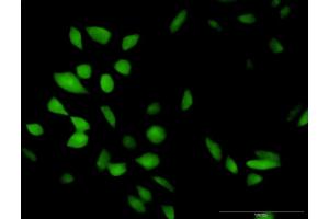 Immunofluorescence of purified MaxPab antibody to CISH on HeLa cell. (CISH antibody  (AA 1-258))