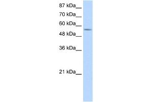 WB Suggested Anti-DDX47 Antibody Titration:  1. (DDX47 antibody  (C-Term))