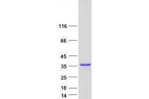 Validation with Western Blot