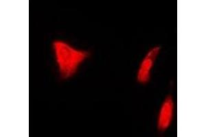 Immunofluorescent analysis of PSMD7 staining in U2OS cells.