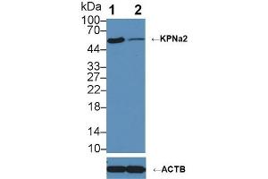 Western Blotting (WB) image for anti-Karyopherin alpha 2 (RAG Cohort 1, Importin alpha 1) (KPNA2) (AA 157-412) antibody (ABIN7435853)