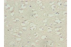 Immunohistochemistry of paraffin-embedded human brain tissue using ABIN7171598 at dilution of 1:100 (TBC1D14 antibody  (AA 136-435))