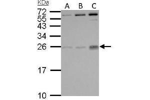 WB Image PLGF antibody detects PGF protein by Western blot analysis. (PLGF antibody)