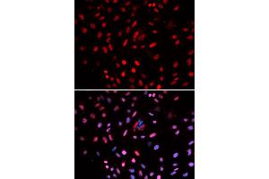 Immunofluorescence analysis of U2OS cells using POLD1 antibody. (POLD1 antibody)