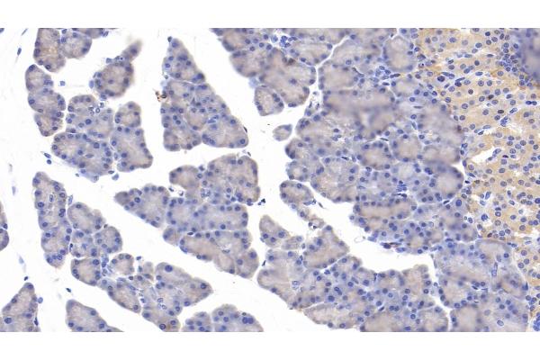 MYH11 antibody  (AA 1-351)