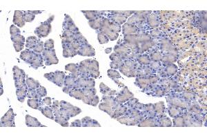 Detection of MYH11 in Rat Pancreas Tissue using Polyclonal Antibody to Myosin Heavy Chain 11, Smooth Muscle (MYH11) (MYH11 antibody  (AA 1-351))