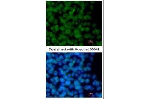 ICC/IF Image Immunofluorescence analysis of methanol-fixed mouse ESC, using ZNF198, antibody at 1:500 dilution. (ZMYM2 antibody  (Center))