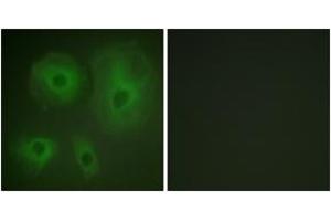Immunofluorescence analysis of HeLa cells, using 14-3-3 thet/tau (Ab-232) Antibody.