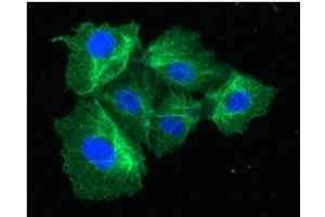 ICC/IF analysis of KRT23 in Hep3B cells line, stained with DAPI (Blue) for nucleus staining and monoclonal anti-human KRT23 antibody (1:100) with goat anti-mouse IgG-Alexa fluor 488 conjugate (Green). (KRT23 antibody  (AA 271-422))