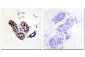 Immunohistochemistry (IHC) image for anti-Microphthalmia-Associated Transcription Factor (MITF) (Ser180), (Ser73) antibody (ABIN1847958) (MITF antibody  (Ser73, Ser180))