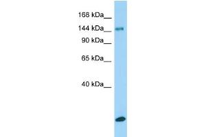 Host:  Rabbit  Target Name:  Col15a1  Sample Type:  Rat Testis lysates  Antibody Dilution:  1. (COL15A1 antibody  (Middle Region))