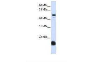 Image no. 1 for anti-Solute Carrier Family 22 (Organic Cation Transporter), Member 7 (SLC22A7) (AA 72-121) antibody (ABIN6738027) (SLC22A7 antibody  (AA 72-121))